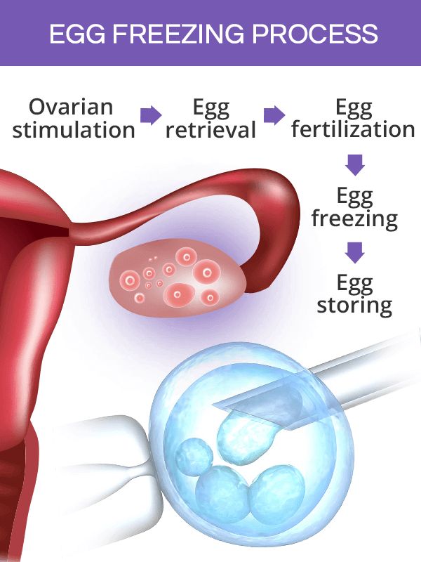 cost of egg freezing